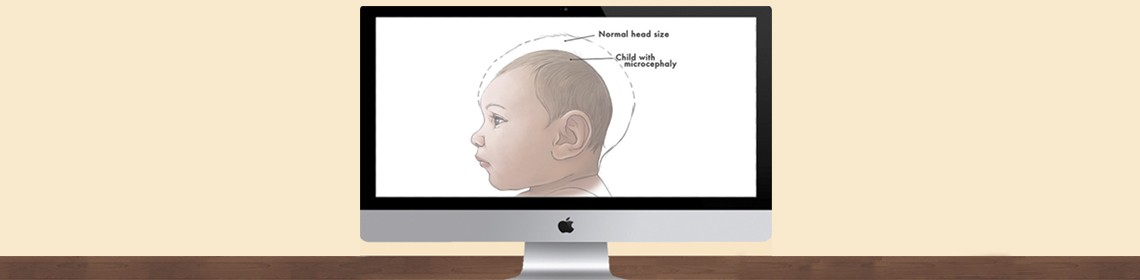 ZIKA VIRUS AND THE POTENTIAL CORRELATION TO MICROCEPHALY