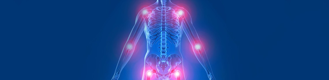 FIBROMYALGIA: CHRONIC PAIN WITH NO GAIN